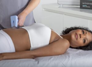 woman with a darker skin tone receiving inmode morpheus8 treatment