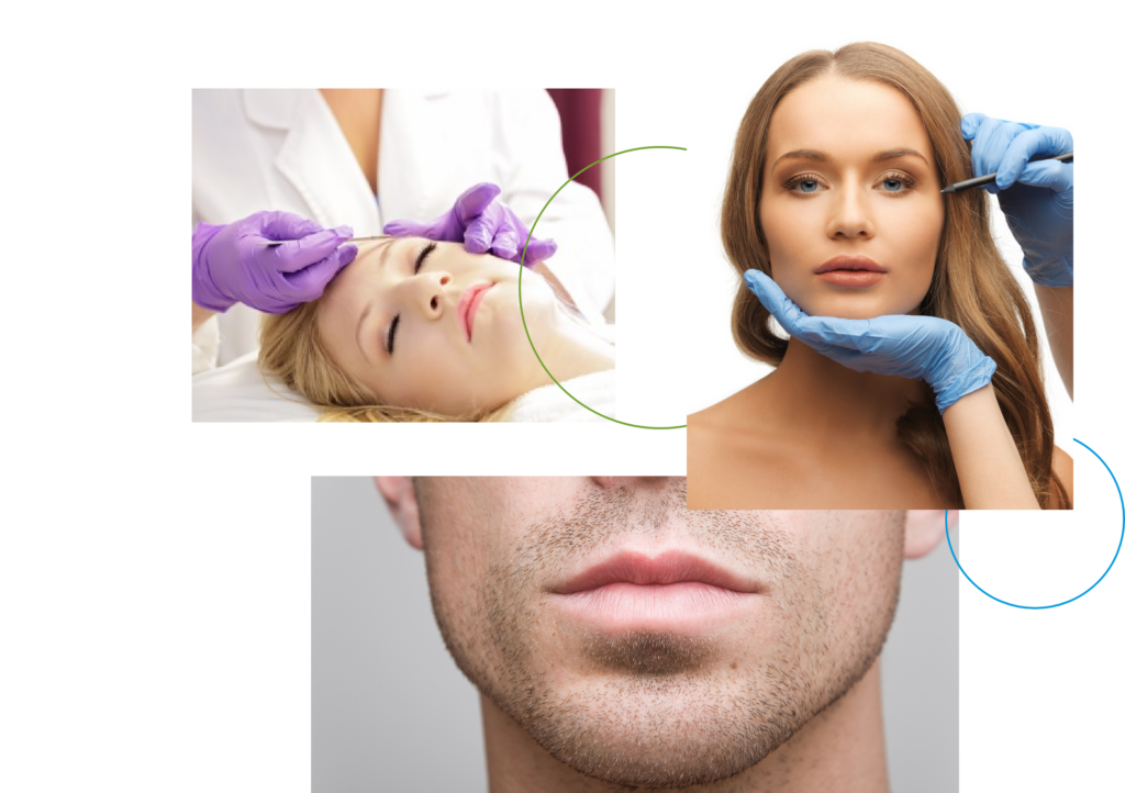collage of images of patients receiving dermal fillers