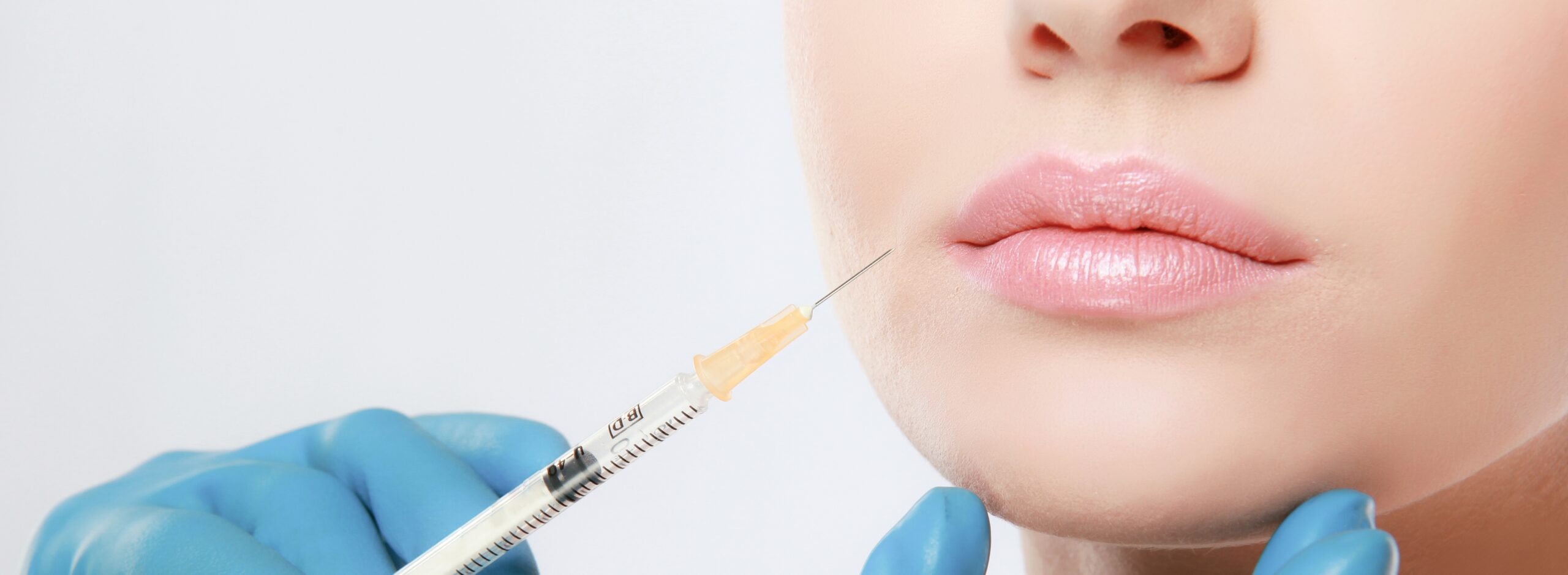 close-up of a woman's mouth about to receive dermal fillers