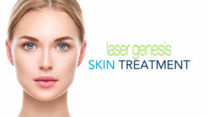white woman with clear skin on laser genesis skin treatment banner