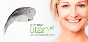 woman smiling next to the titan xl skin tightening treatment