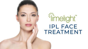 woman with clear skin on banner for limelight IPL face treatment banner