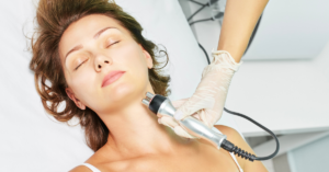 thirty year old woman receiving rf therapy from a trained professional